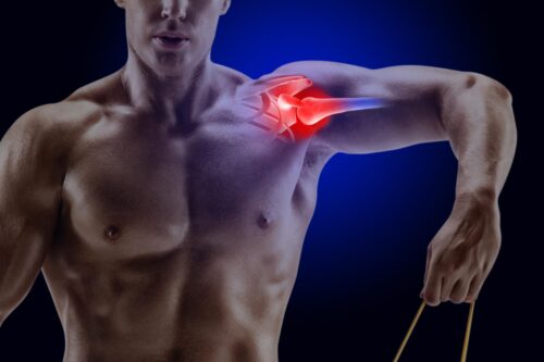 Dor no ombro? Lesão do manguito rotador: causas, sintomas e tratamento.