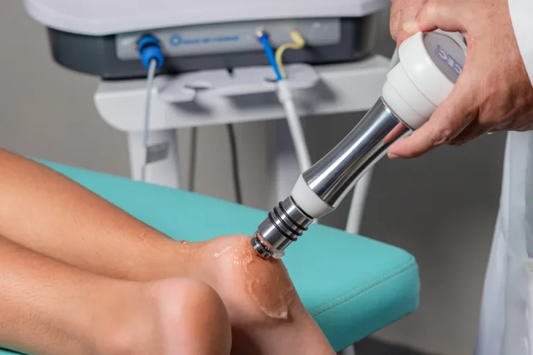 Terapia por Ondas de Choque: como funciona, quais são os benefícios e quando é indicada?